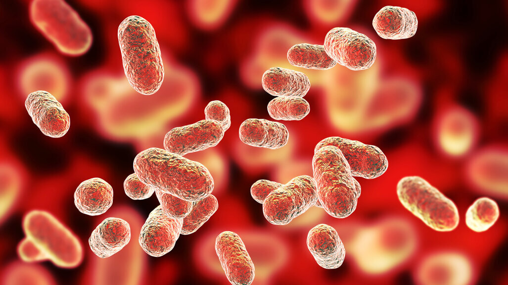 Periodontal disease and coronary artery disease share genetic basis