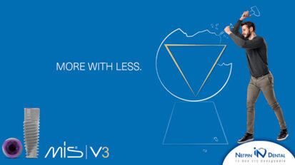 V3 implant by MIS | More with Less / NΕΓΡΙΝ ΙΝ Dental