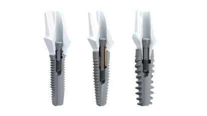 Nobel Biocare napoveduje partnerstvo s podjetjem 3Shape