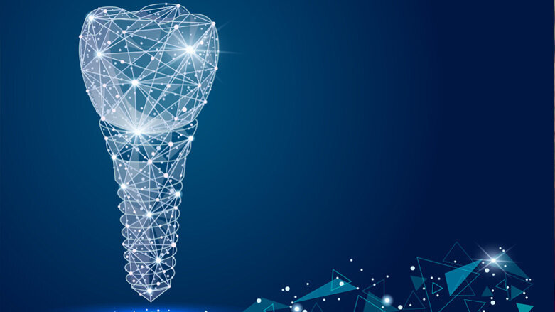 Individuelle Implantate basierend auf CAD/CAM-Verfahren
