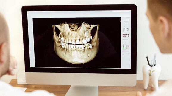 Ohne Strahlenbelastung: Kieferorthopädische Behandlungsplanung