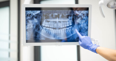 Jedes achte Röntgengerät mit Mängeln – das zeigt der TÜV-Report