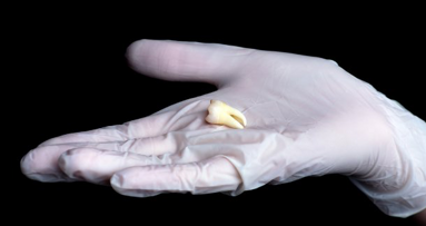 Un análisis de los dientes ofrece mayor precisión para detectar la edad