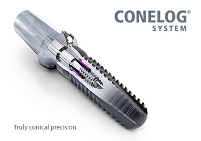 CONELOG IMPLANT SYSTEM