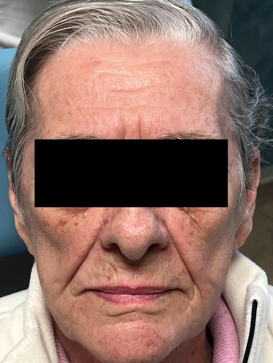 Fig. 1_Volto in prima visita.