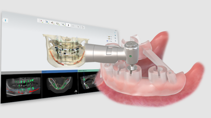OneGuide da Osstem Implant celebra 10.º aniversário