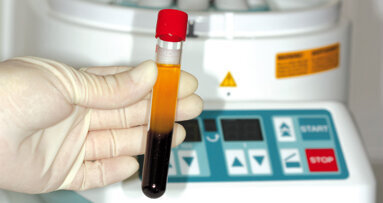 Online-Fortbildung:  Mit körpereigenen Wachstumsfaktoren Wundheilung optimieren