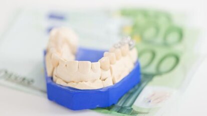 Suécia: opiniões de dentistas sobre comparação de preços de serviço variam