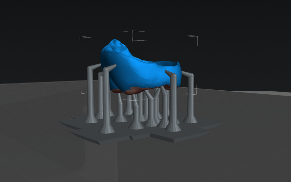 Fig. 8b: Crown positioned on the virtual build platform in CHITUBOX Dental with supporting structures applied prior to 3D printing.
