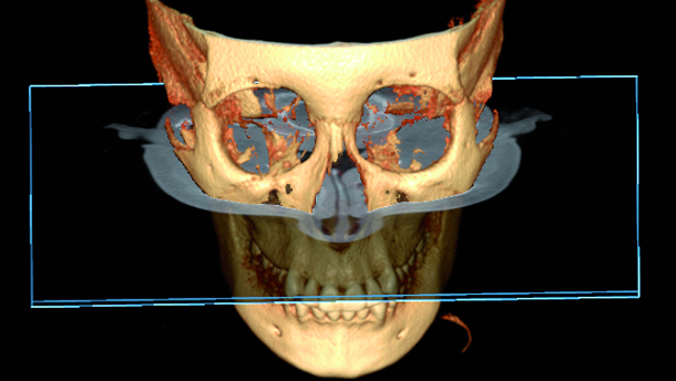 The role of 3-D imaging systems in present orthodontics