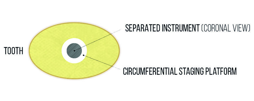 Fig. 6 : Représentation schématique d’une plate-forme de travail. 