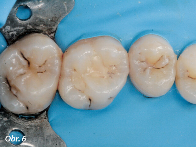 Izolace pracovního pole.