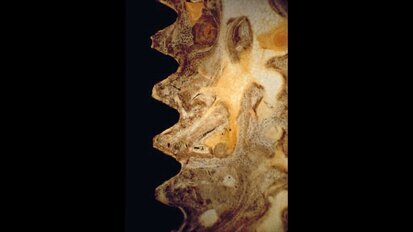 Metodo agli elementi finiti in implantologia: stato dell’arte e direzioni future