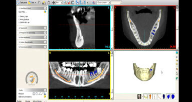 Materialise Dental and Zimmer Dental establish partnership