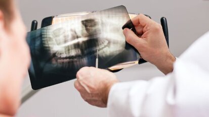 Учени от „Шарите“ проучват методи за надеждното откриване и лечение на кариесите