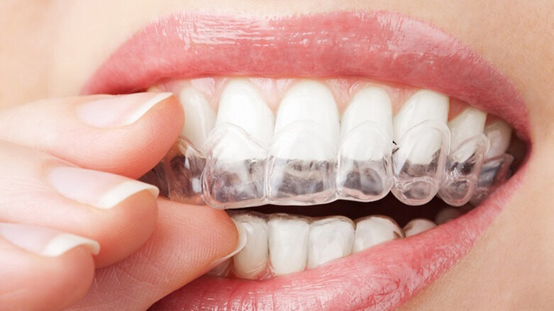 Posune COVID-19 ortodoncii dále do digitálního prostoru?