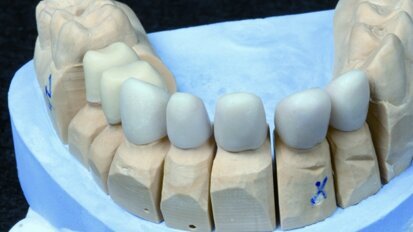 Zirkoniumdioxid – ZrO2 Zirkoniumdioxid – ZrO2