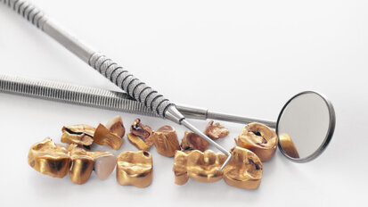 Oude kronen hebben grote waarde, maar hoeveel precies?