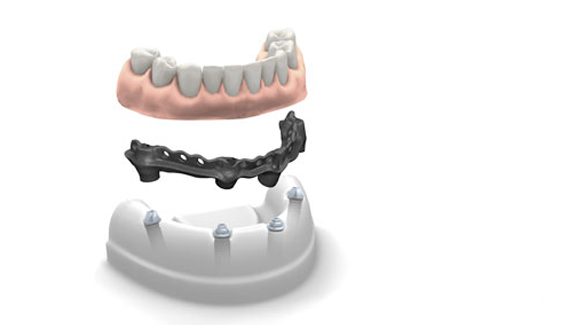 Phibo präsentiert Phixoss & Certia Guide auf der IDS