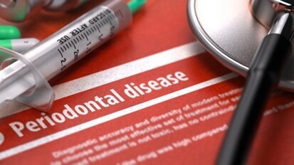 Estudo liga doença periodontal, perda de dentes e maior risco de morte