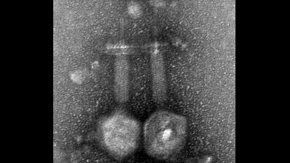 וירוס חיידקים הנמצא בשפכים של ירושלים יכול למנוע זיהומי תעלות שורש