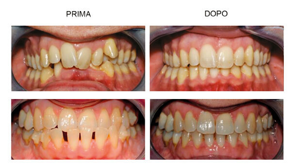 Una consulenza online di qualità per offrire il trattamento Invisalign® ai propri pazienti