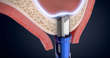 Osstem Implant announces call for abstracts for London event—and CAS-KIT prize