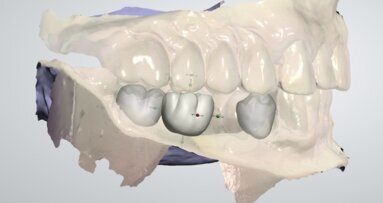 Wykorzystanie możliwości technologii CAD/CAM na etapie planowania i leczenia – aspekty techniczne