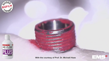 EMS Minimal-Invasive AIRFLOW and PIEZON EMS Minimal-Invasive AIRFLOW and PIEZON