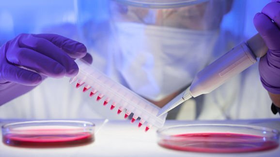 Pesquisadores de Odontologia completam teste de HIV para uso no mundo em desenvolvimento