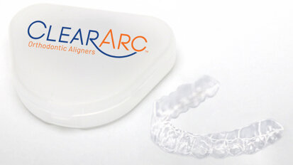 Western Dental enters clear aligner market Western Dental enters clear aligner market