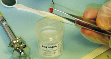 Klucz do wczesnej diagnostyki chorób nowotworowych