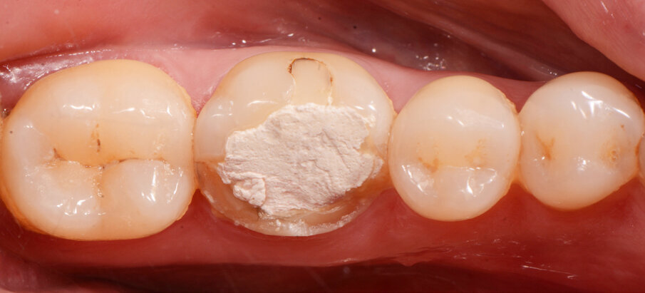 Fig. 1: Preoperative situation