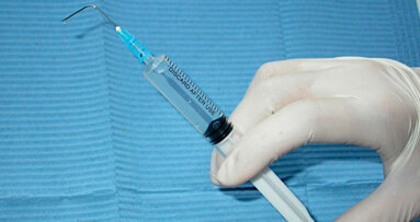 L’irrigazione canalare nell’endodonzia moderna: casi semplici