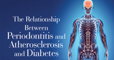 The Relationship between Periodontitis and Atherosclerosis and Diabetes