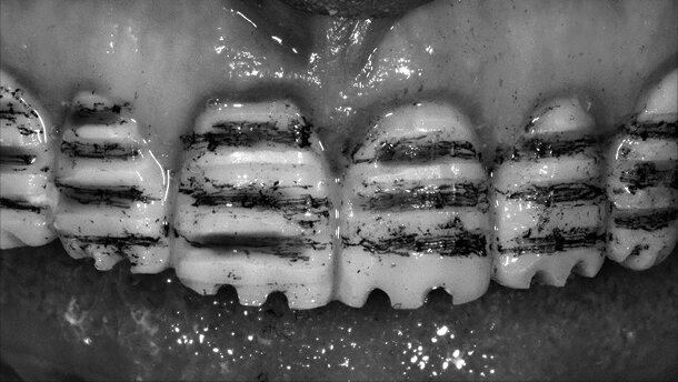Interdisciplinární přístup v estetické stomatologii