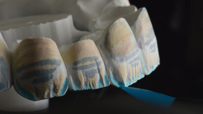 IDS 2023: Discover new opportunities with products from Kuraray Noritake Dental