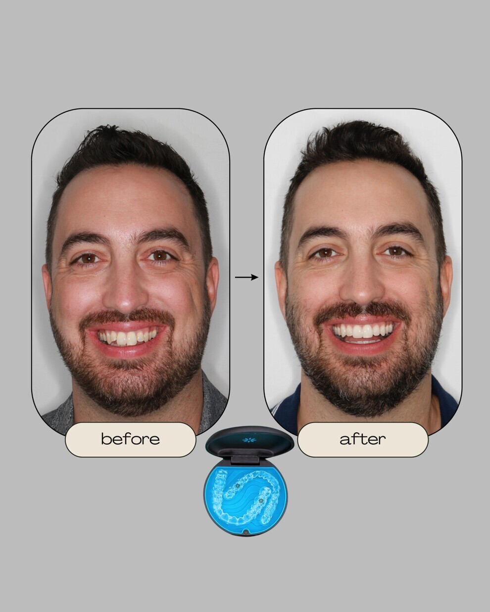 Mobile apps are becoming more important in daily life, and with the rise of orthodontic apps and rapid advances in artificial intelligence, they offer great potential benefits for both clinicians and patients.