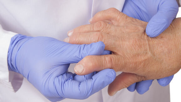 No evidence for link between periodontal disease and rheumatoid arthritis