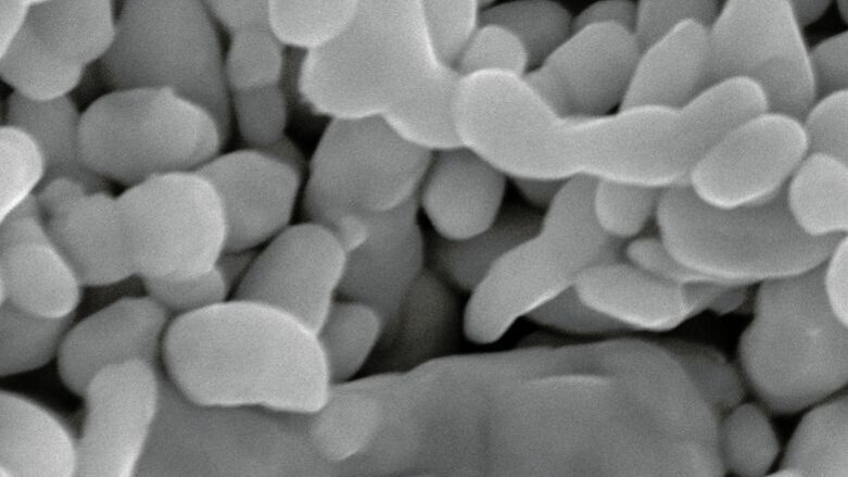 Silver nanoparticles in dentistry