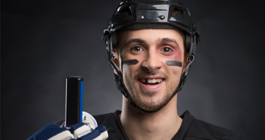 Sport ist schlecht für die Zähne