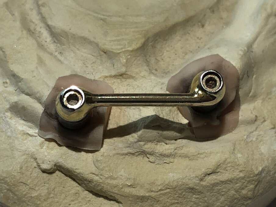 Afbeelding 3. Staafconstructie.