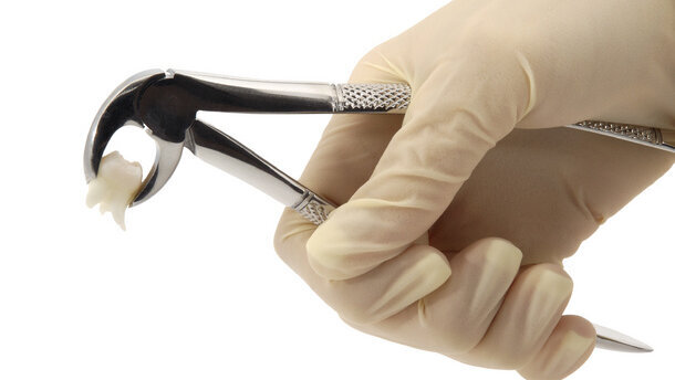 Utrata jednego zęba to kalectwo!