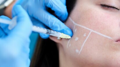 Orthodontics and botulinum toxin: Integrated care of a patient with bruxism and occlusal alteration