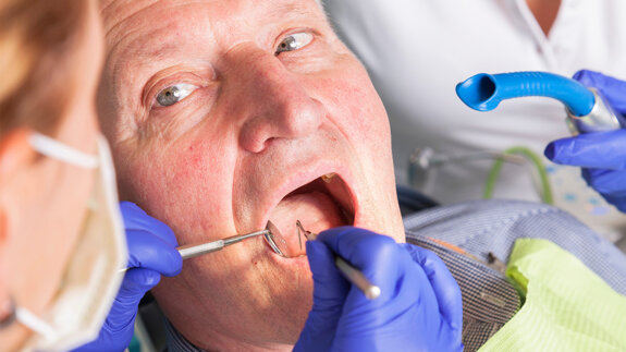 Wenn Zähne schneller ausfallen: Was das über die Lebenserwartung aussagt