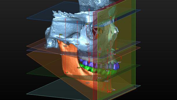 Comunicazione ortodontica per immagini del terzo millennio: dal 2D al 3D