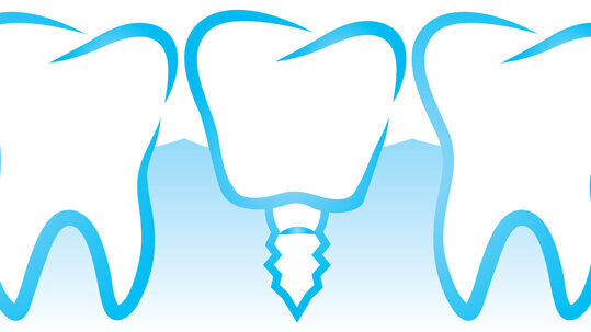 International Society of Metal-Free Implantology gegründet