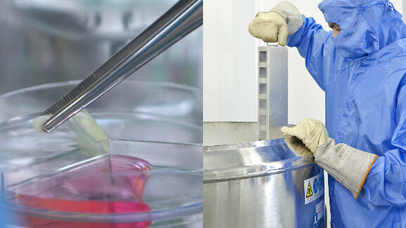 Diferenças entre as células-tronco da polpa do dente de leite e sangue do cordão umbilical