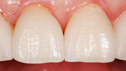 Changing grey–white back to red–white