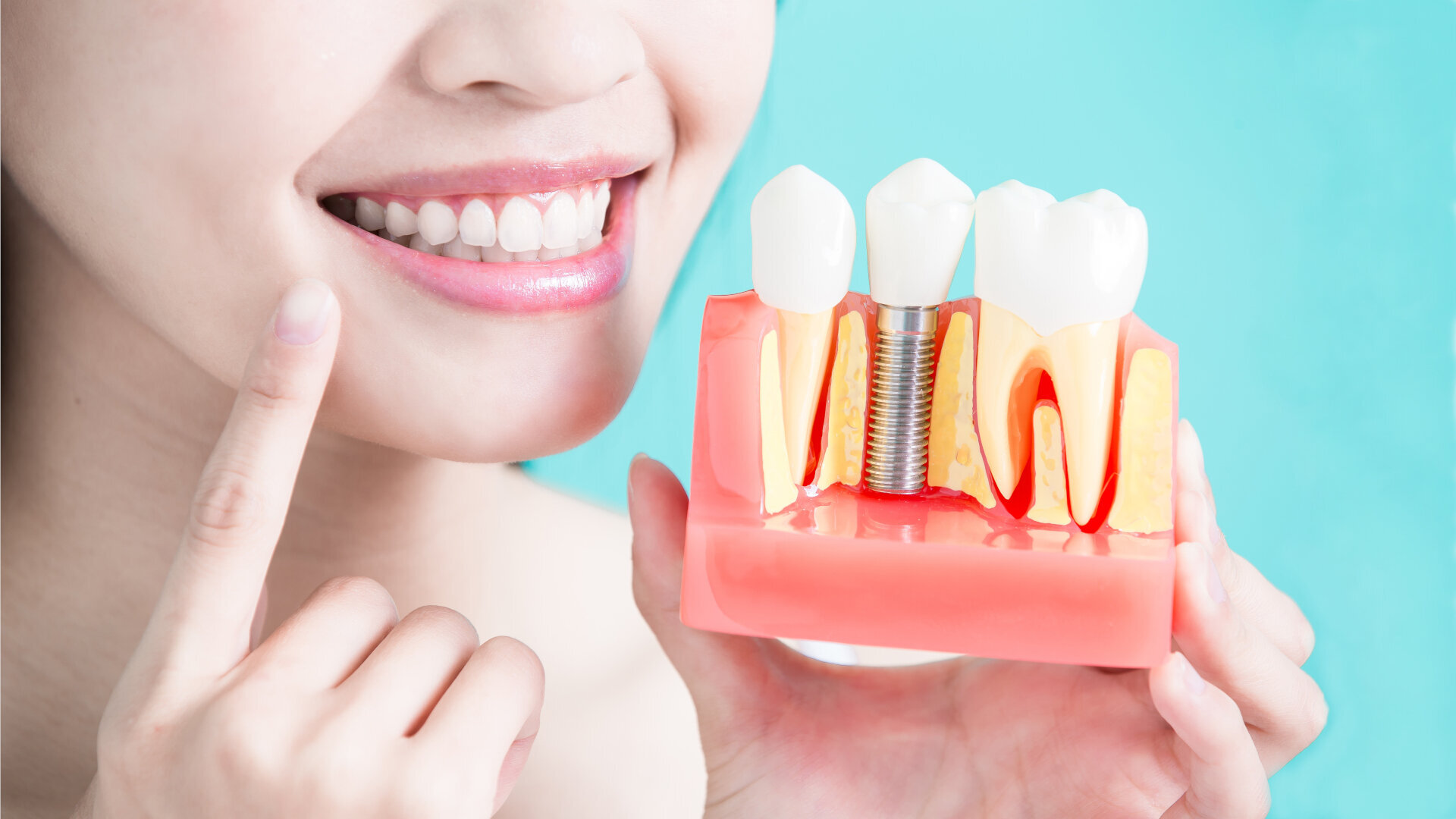 Mais implantes por menos: China arrasa nos resultados do primeiro trimestre com compras baseadas em volume